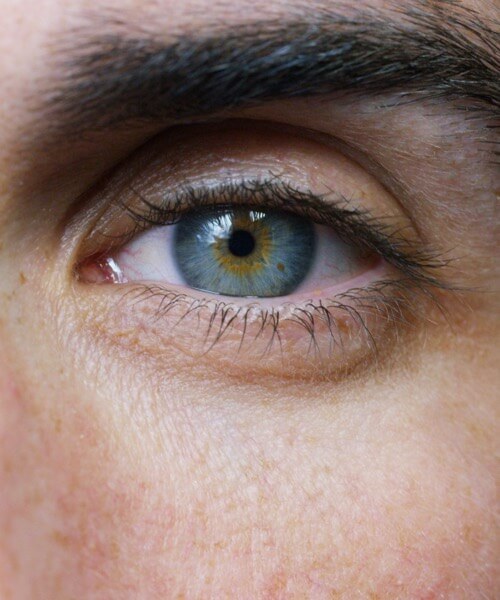 Closeup of an Eye